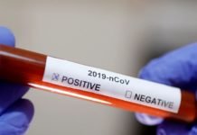 Brasil tem 22,1 mil casos de covid-19; mortes chegam a 1,2 mil